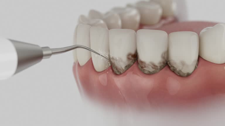 Reliable Dental Implants contractor in Fairview, OR by Smile Center Dentistry